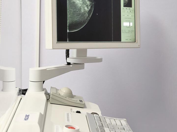 Naše mamografické centrum patrí medzi TOP 5 skríningových mamografických pracovísk na Slovensku. Naše mamografické centrum patrí medzi TOP 5 skríningových mamografických pracovísk na Slovensku.
