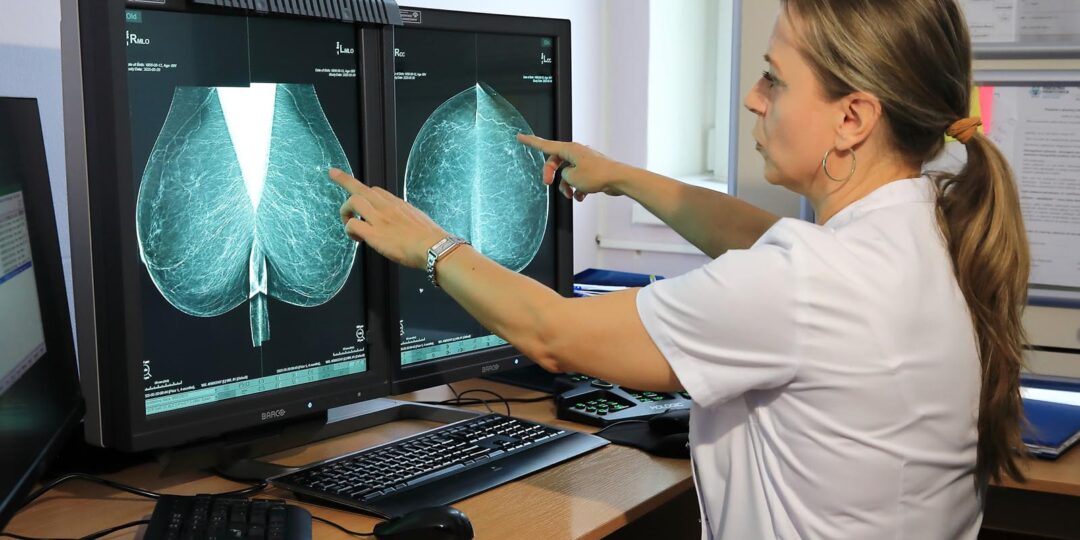 Naše mamografické centrum patrí medzi TOP 5 skríningových mamografických pracovísk na Slovensku. Naše mamografické centrum patrí medzi TOP 5 skríningových mamografických pracovísk na Slovensku.