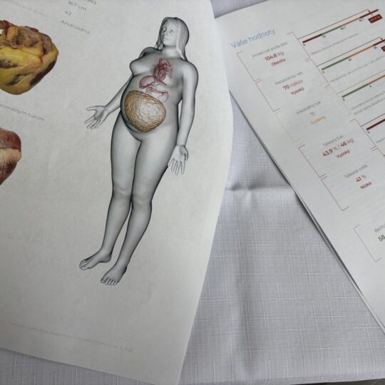 článok: Svetový deň diabetu Prevencia, merania aj odborné poradenstvo článok: Svetový deň diabetu Prevencia, merania aj odborné poradenstvo