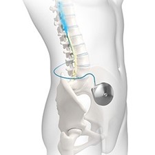Centrum neuromodulácie