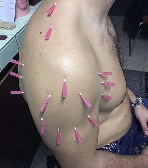 FNsP NZ - Nová ambulancia pre liečbu CHRONICKEJ BOLESTI